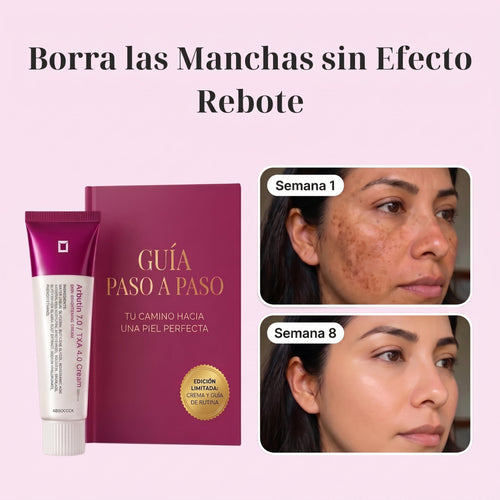 Crema Despigmentante de Manchas con Arbutina