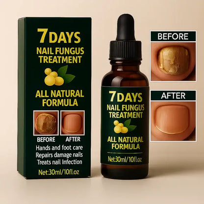 Tratamiento para los hongos de las uñas 💅