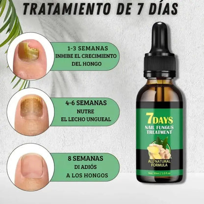 Tratamiento para los hongos de las uñas 💅